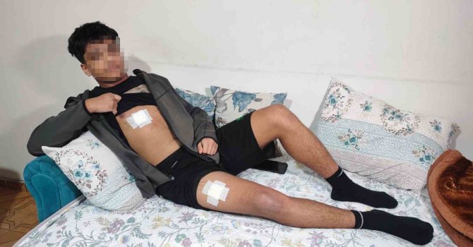 Akran zorbalığı az kalsın öldürüyordu: Önce dövüldü sonra bıçaklandı