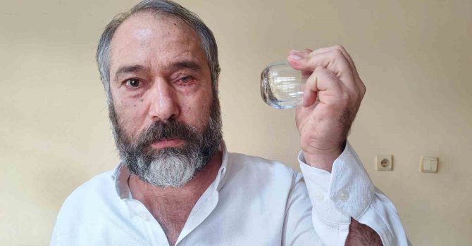 ‘Küfürlü konuşmayın’ diye uyardı, gözünden oldu