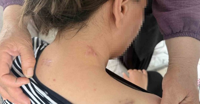 17 bıçak darbesi aldı, ölü numarasıyla kurtuldu, kocasının en ağır cezayı almasını istedi