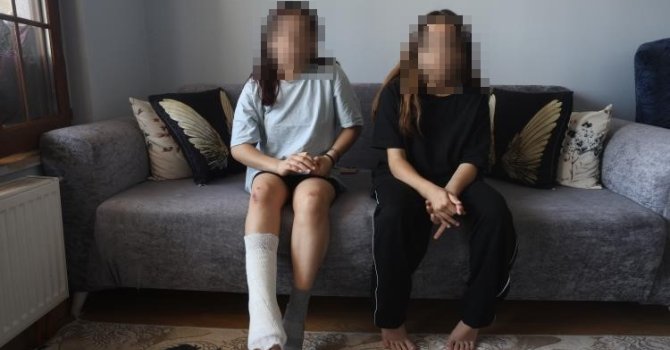 Köpeklerin saldırısında kabusu yaşayan kardeşlerin biri yaralandı, diğerindeyse kafa sallama travması oluştu