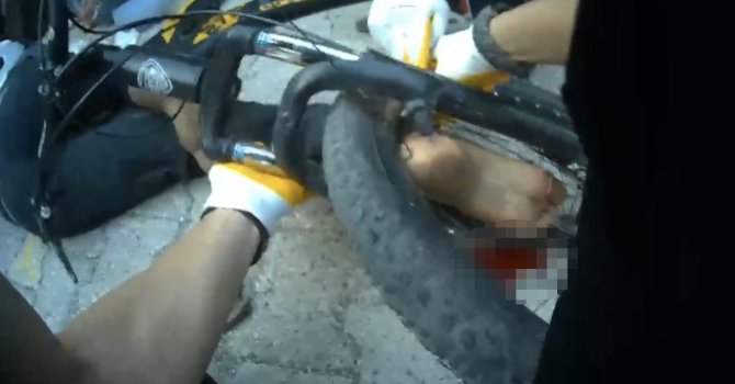 Osmaniye’de ayağı bisikletin tekerine sıkışan çocuk ekiplerce kurtarıldı