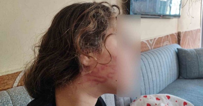 8 yaşındaki kızını darp eden çocuğun epilepsi hastası ablasını sokak ortasında dövdüğü iddiası