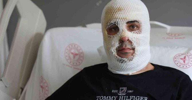 Ekmek teknesi küle dönmesin diye mücadele eden esnafın yüzü ve vücudu yaşanan patlamayla yandı