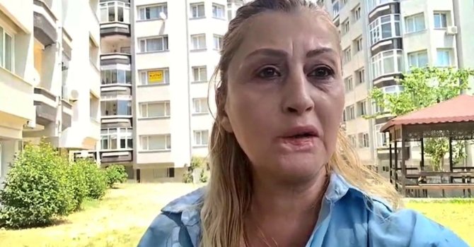 Estetik işlem sonrası dudağı çürüdü, 7 yıldır hukuk mücadelesi veriyor