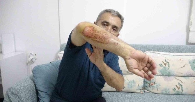 Otizmli oğluyla doğa gezisi sırasında sahipli köpeklerin saldırısına uğradı