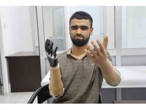 Demirin elektrik tellerine değmesiyle hayatı kararan Muhammed, 3 milyon TL değerindeki protez bacağına ve 2 biyonik koluna kavuştu