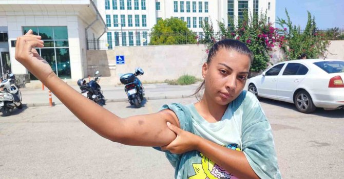 Cankurtaran kadın, öğretmen amcası tarafından darp edildi