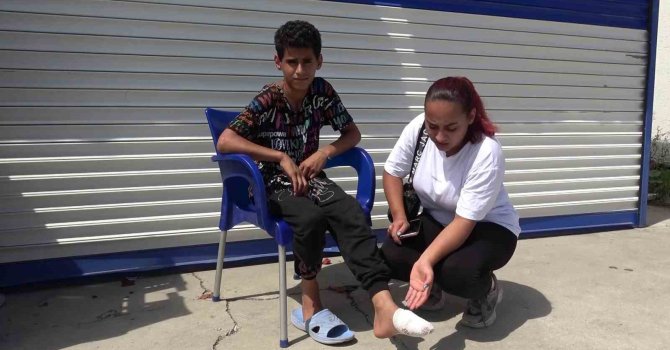 ’Severdim’ dediği sokak köpeğinin ısırdığı çocuk ayağından yaralandı