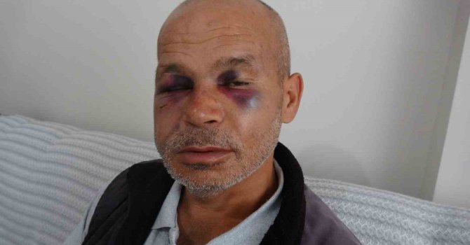Engelli adamı darbeden şüpheli serbest bırakıldı