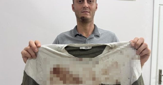Gürültü tartışması sopalı kavgayla bitti: O anlar kamerada