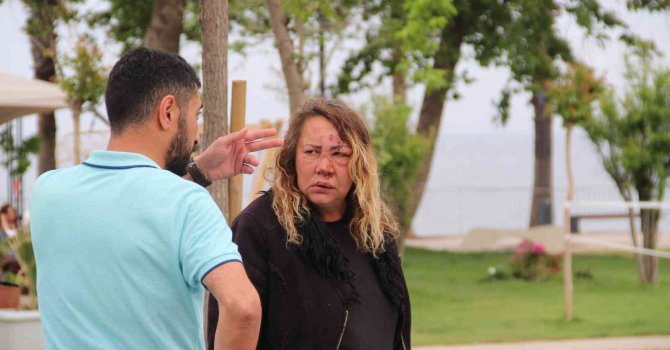 Darp edilmiş olarak yardım isteyen Rus kadın hastaneye kaldırıldı