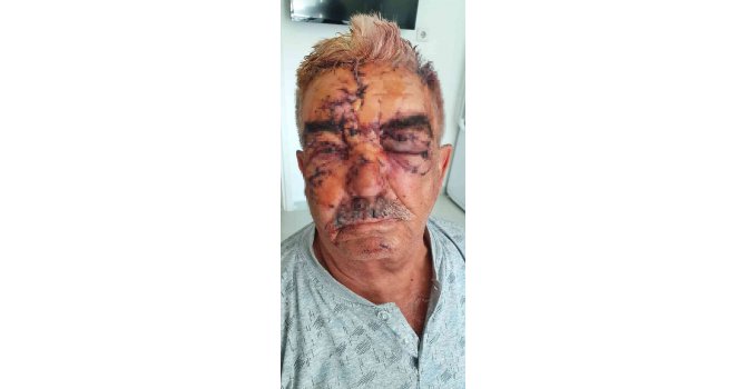 Beslediği komşusunun köpeğinin saldırısına uğradı