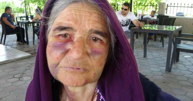 Kuzusunu sürüden almak isterken dayak yedi, yüzü tanınmaz hale geldi