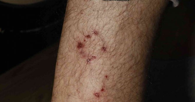 Ailesiyle evine giderken köpeklerin saldırısına uğradı