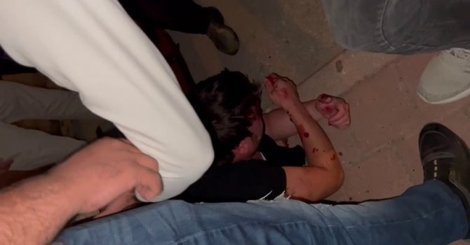 Tacizci sokak ortasında öldüresiye darp edildi