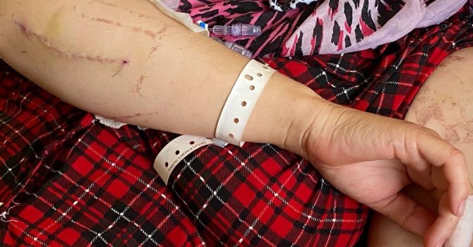 Evin elektriğini kesip kapıyı açtıran eşi tarafından 24 yerinden bıçaklandığı anları gözyaşları içinde anlattı