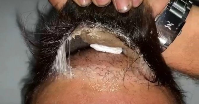 Şüphelinin peruğundan uyuşturucu çıktı