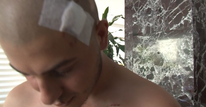 Tur teknesi çalışanı 6 kişi tarafından sopalarla ve demir çubukla dövülen genç İHA’ya konuştu