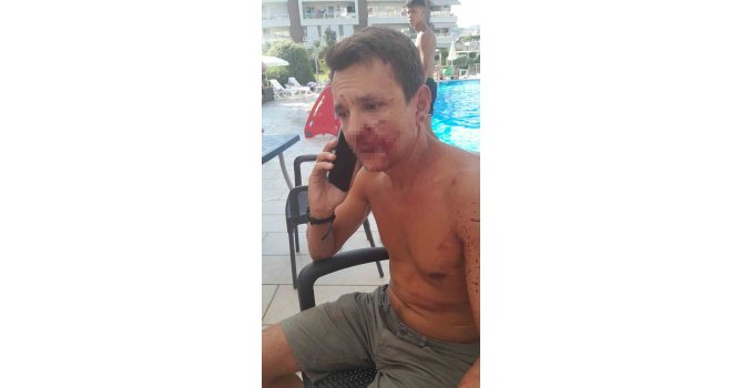 Alanya’da yaşayan Rus’u site yöneticisinin darp ettiği iddiası