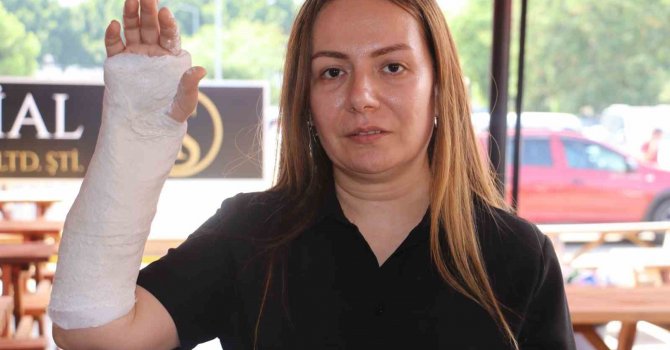 Pitbullun saldırısından köpeğini kurtaran kadın kaldırıma düşüp kolunu kırdı