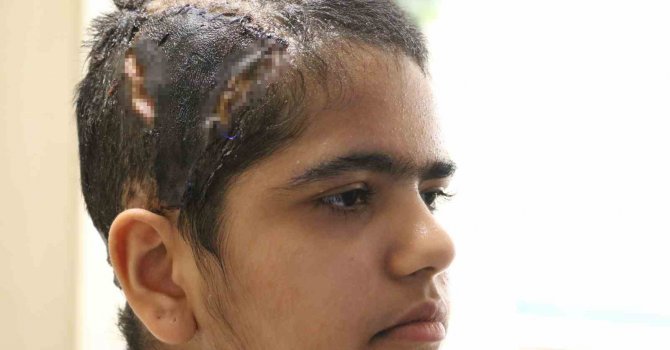 Eğlenmek için bindiği go-kart’ta saçı tekere dolanan genç kız canından oluyordu