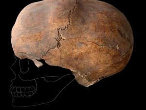 Yassıhöyük’te 6 bin yıllık kafatası bulundu