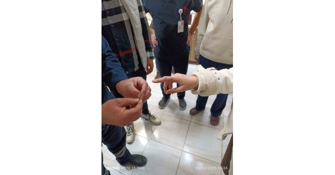 Parmağında yüzük sıkışan vatandaşın yardımına itfaiye koştu