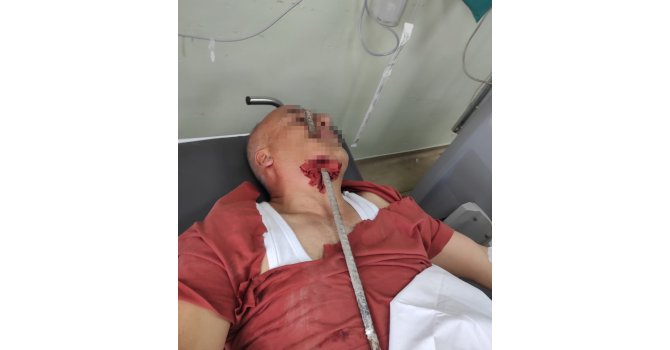 İnşaat işçisinin yüzüne demir saplandı