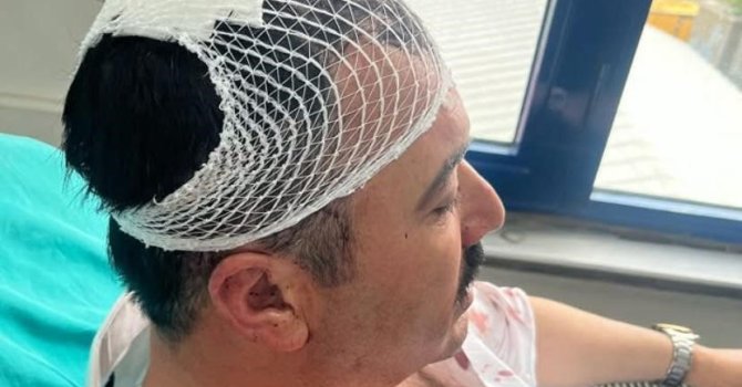 Yeniden Refah Partili Başkan Yardımcısı, belediye başkan yardımcısının kafasına şekerlikle vurdu