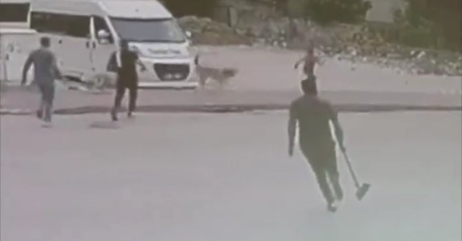 Sokak köpekleri çocuğa saldırdı