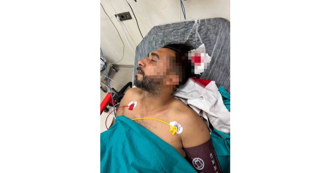 Adana’da döner ustası çalışırken başından yorgun mermiyle yaralandı