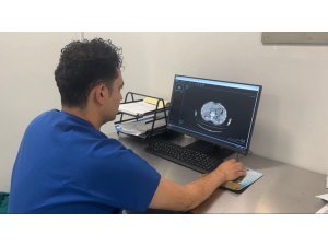 Osmaniye’de ilk kez kapalı ameliyatla böbrek tümörü başarıyla alındı