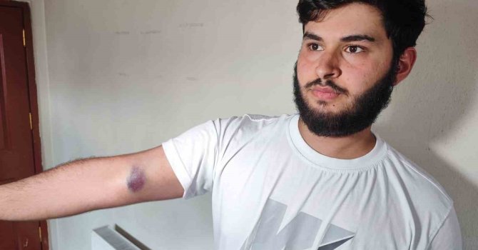 Conolar hem topu vermedi hem de aileye sopalı silahlı saldırıda bulundu