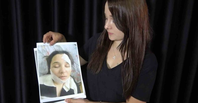 Eski sevgilisi tarafından öldüresiye darp edilen genç kadın yaşadığı kâbusu anlattı