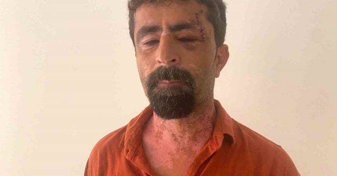 Antalya’da öfkeli damat kayınpederini hastanelik etti