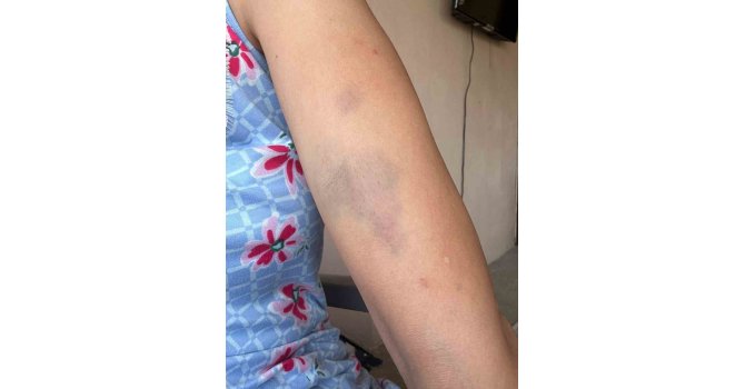 Veteriner ve ailesine ‘Sokak köpeklerini besledin’ dayağı iddiası