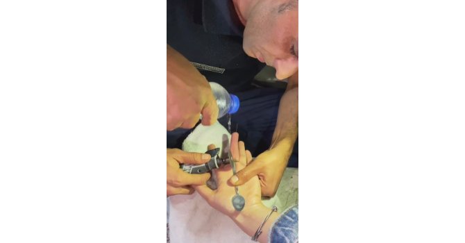 Parmağına yüzük sıkışan vatandaşın imdadına itfaiye ekipleri yetişti