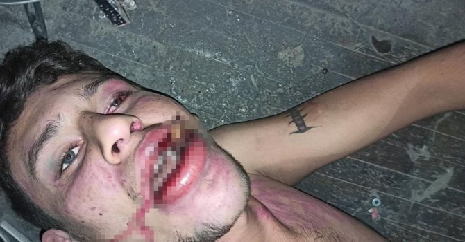 Antalya’da "Böcek yedirip dişlerimi kırdılar" iddiasına 20 yıl hapis talebi