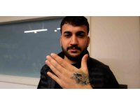 Dövme sildirmek isterken kabusu yaşadı, elindeki dokular öldü