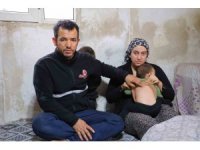 Kahramanmaraş’ta belinden zımba teli çıkan bebeğin ailesi sorumluların ceza almasını istedi