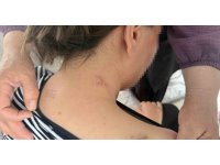 17 bıçak darbesi aldı, ölü numarasıyla kurtuldu, kocasının en ağır cezayı almasını istedi