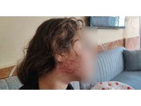8 yaşındaki kızını darp eden çocuğun epilepsi hastası ablasını sokak ortasında dövdüğü iddiası