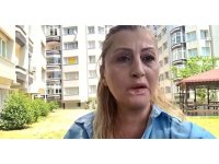 Estetik işlem sonrası dudağı çürüdü, 7 yıldır hukuk mücadelesi veriyor