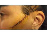 Eski sevgilisinin yüzünü usturayla kesen adam tutuklandı