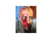 Orman muhafaza memurunu darbeden 4 şüpheli gözaltına alındı