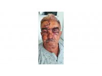 Beslediği komşusunun köpeğinin saldırısına uğradı