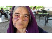 Kuzusunu sürüden almak isterken dayak yedi, yüzü tanınmaz hale geldi