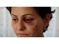 Arabayla takip ettikleri anne ve kızı döverek hastanelik ettiler