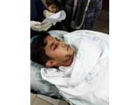 Beyin tümörünü atlattı, enkazdan sağ çıkarıldı