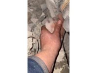 Niğde UMKE ekiplerinden enkaz altındaki vatandaşa hayat eli